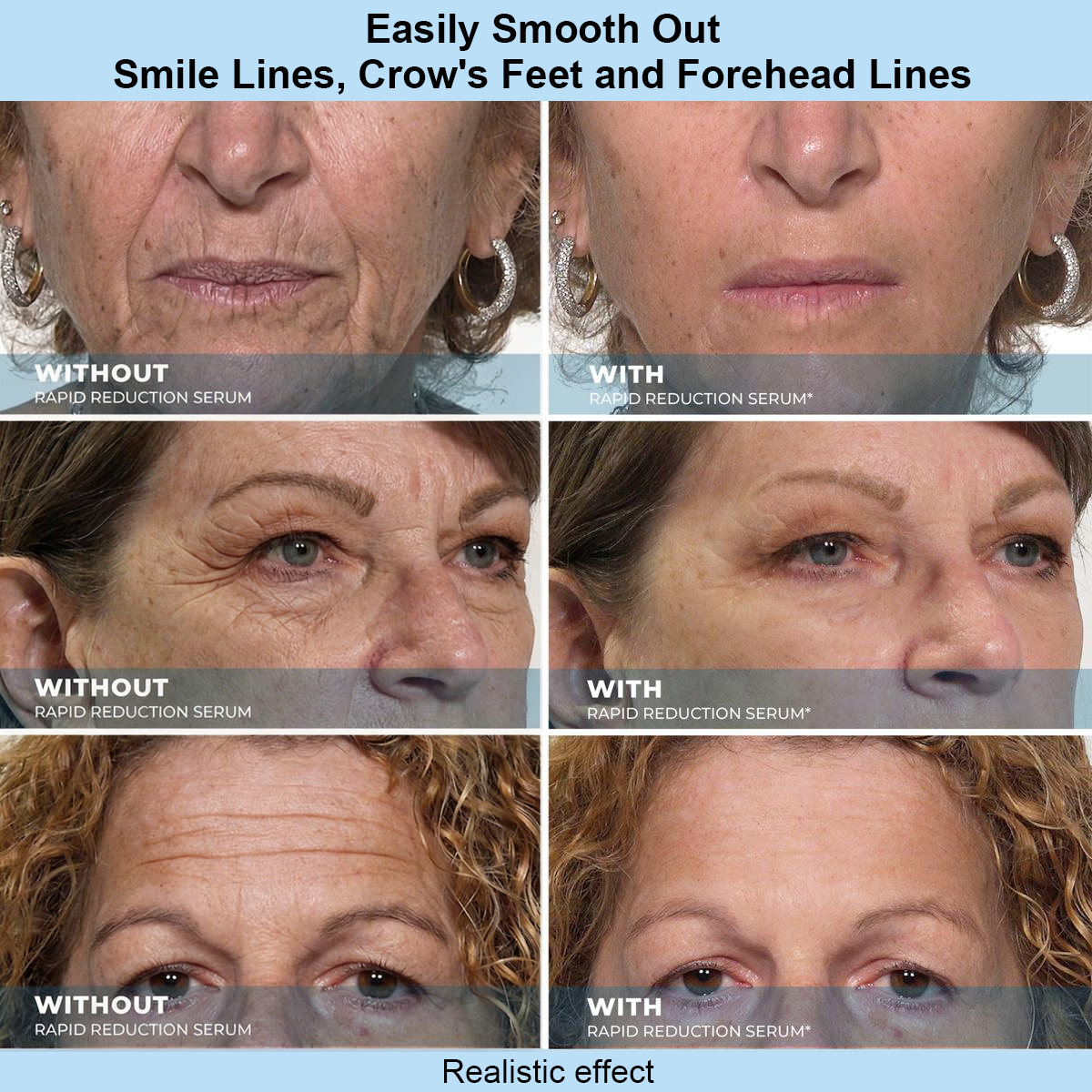 Xyltor™ Instant Face Temporary Tightener – Instant visible results in 30 seconds
