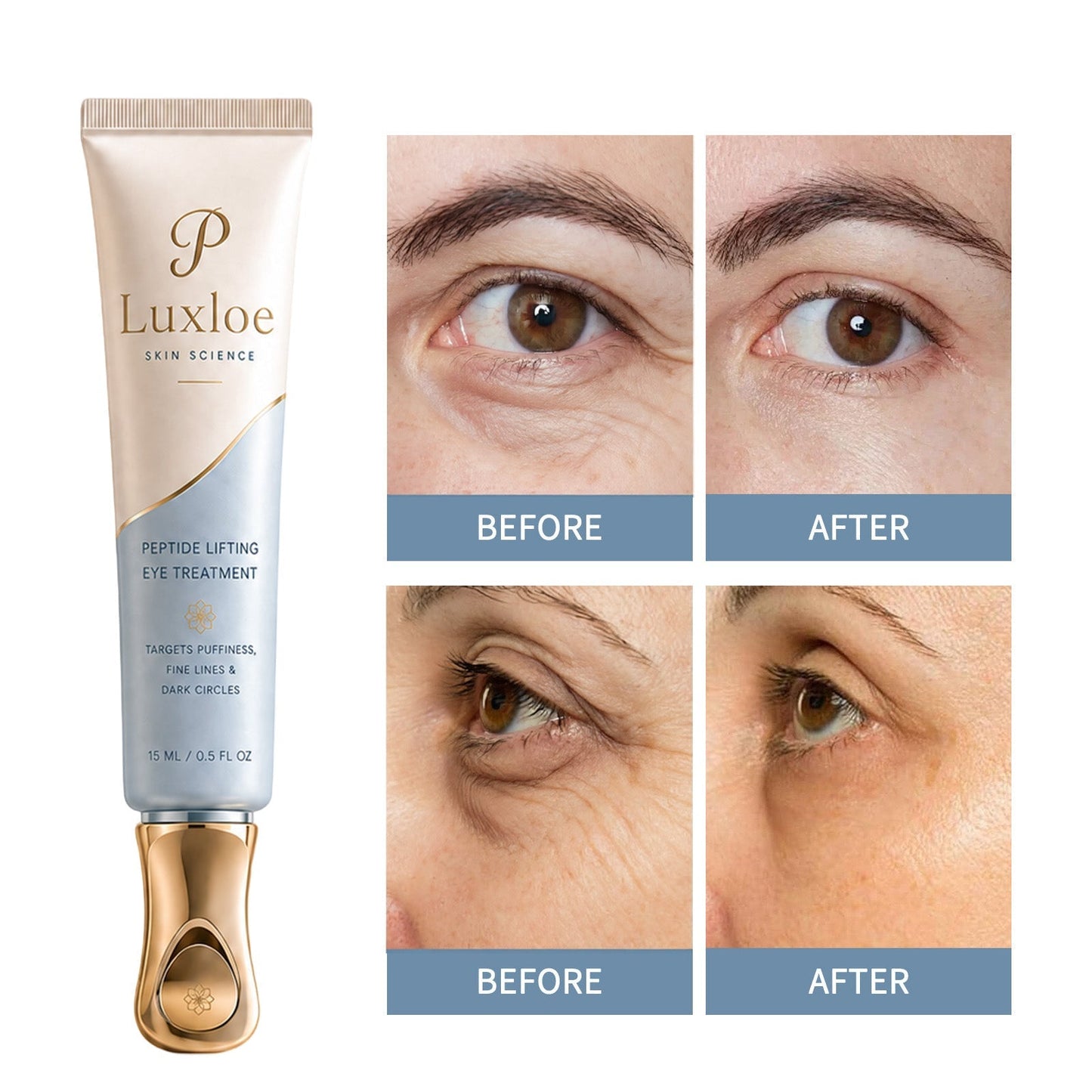 Xyltor™ Instant Face Temporary Tightener – Instant visible results in 30 seconds
