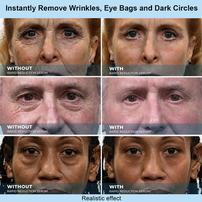 Xyltor™ Instant Face Temporary Tightener – Instant visible results in 30 seconds